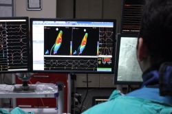 Kalpte ritim bozukluğuna dikkat!