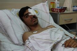 PKK’nin bombalı saldırısıyla hayatı karardı