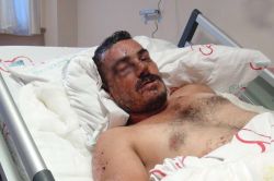 Elazığ’daki patlamada ağır yaralanan kamyoncu o anları anlattı video