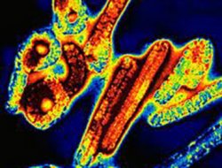 Uganda'da Korkutan Virüs; Ondan Fazla Can Aldı