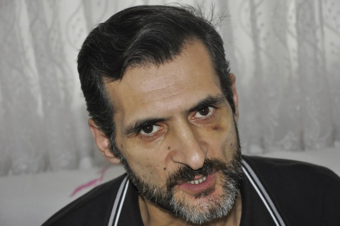 Yoğun bakımdaki hastaya darp iddiası