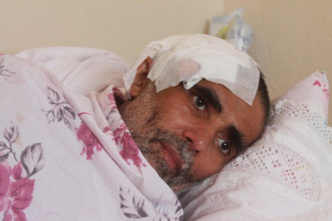 Hüseyin Akbalık yoğun bakıma kaldırıldı