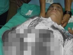 Bomba göstericinin elinde patladı