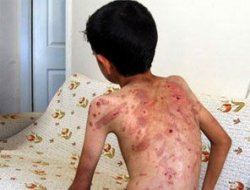 Şeker toplayan çocuklara işkence!