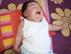 Doğumda Gördüğü Baskı Bebeği Sakat Bıraktırdı İddiası