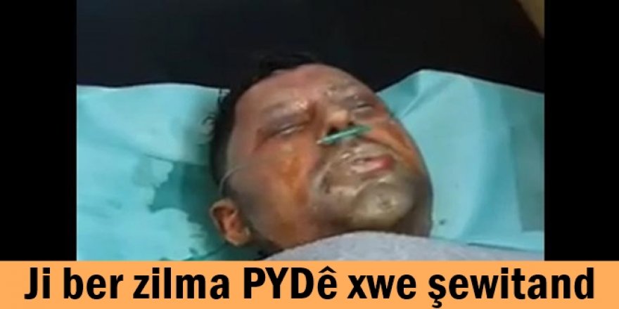 Ji ber zilma PYDê xwe şewitand