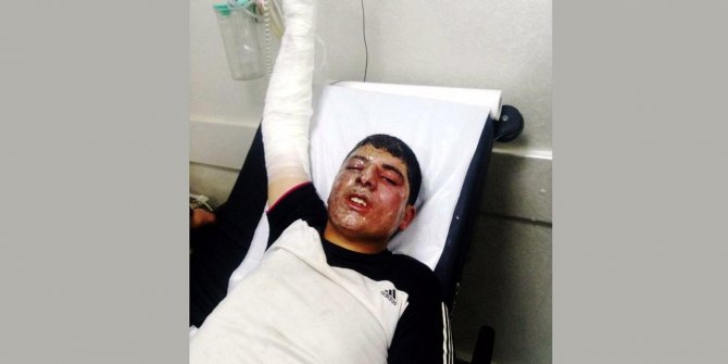 Şalteri kaldırırken yaralandı