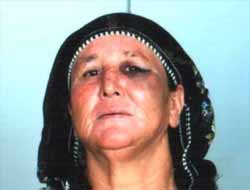 Gördüğü Şiddetten Kocasını Mahkemeye Verdi