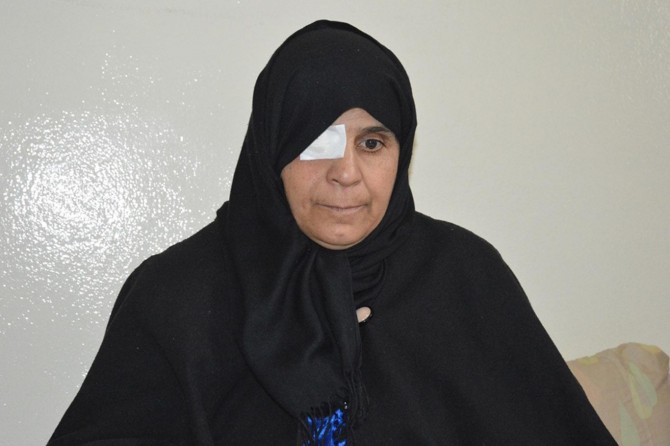 Suriyeli kadın ikinci gözünü de kaybetmek istemiyor