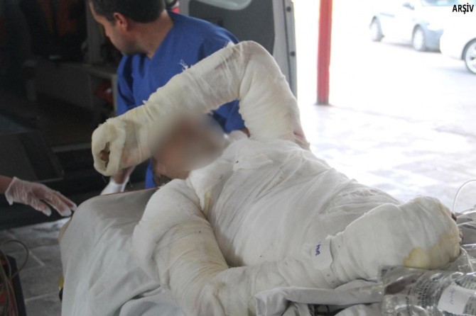 Elektrik akımına kapılan işçi ağır yaralandı