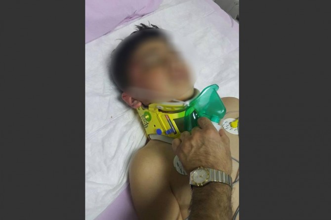 Otomobilin çarptığı çocuk yaralandı