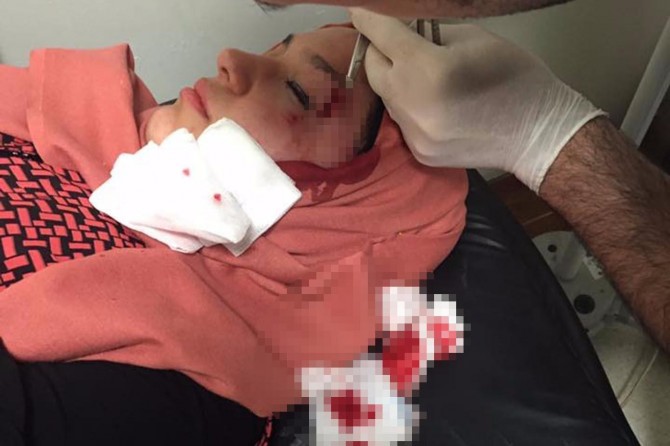 Referandum çalışması yapan AK Partili kadınlara saldırı