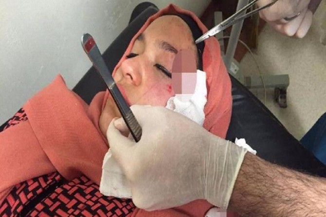 Êrîşî pîrêkên AK Partiyî yên ku xebatên referandûmê dikirin hat kirin