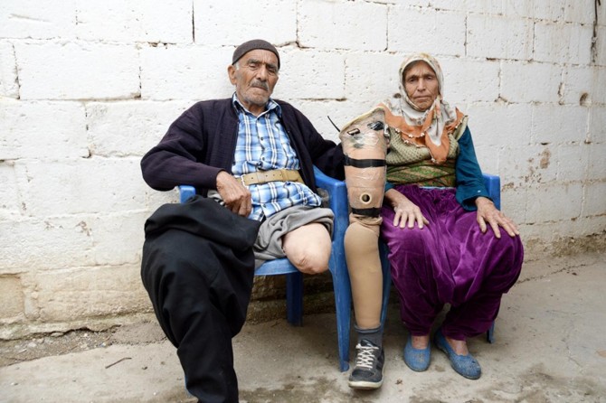 Protez bacaklı yaşlı amca mağduriyetinin giderilmesini istiyor