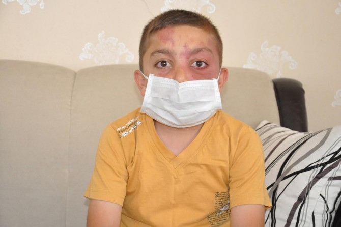 Batman'da damar tümörüne yakalanan çocuk için kampanya başlatıldı