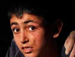 Yunus`un Ailesi Gerekli Desteği Görememiş