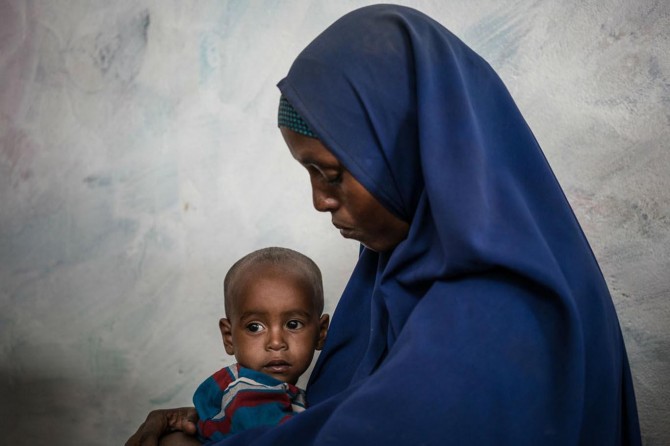 Somali’de 1,4 milyon çocuk aç