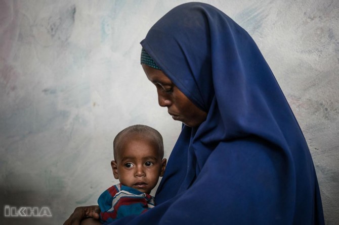 1.4 million Children hungry in Somalia