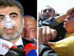 Bakan yumruklayan öğretmen Bakandan özür diledi ve...