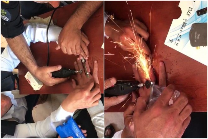 Mardin Artuklu’da parmağına taktığı rulman çıkmayınca itfaiye müdahale etti