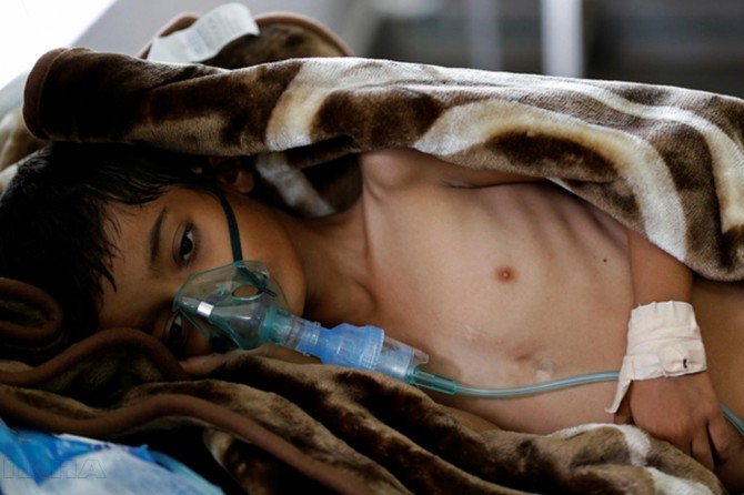 Hejmara kesên ku li Yemenê ji ber nexweşiyakolêrayê mirin derket 180yî