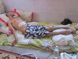 Felçli Gencin Dramı