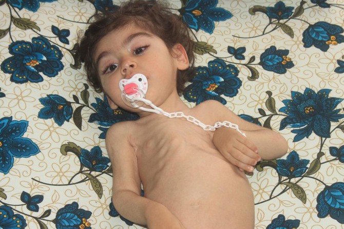 Bir annenin feryadı: Kızım gözümün önünde günbegün eriyor