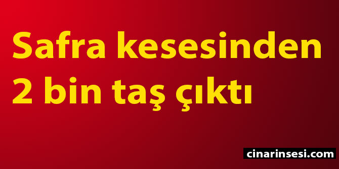 Safra kesesinden 2 bin taş çıktı