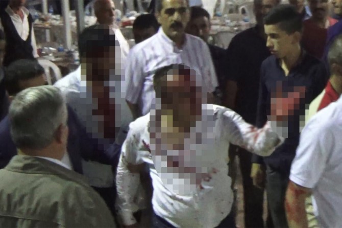 Husumetli aileler arasında kavga: 5 yaralı