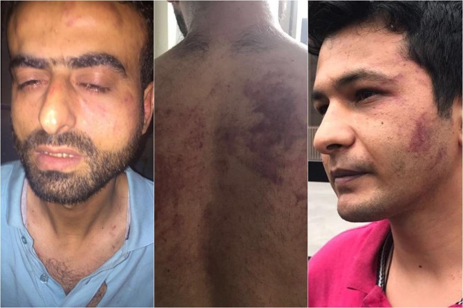 Polis şiddetine ilişkin suç duyurusunda bulunulacak