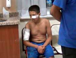 Hasmının 12 Yaşındaki Çocuğunu Yaraladı