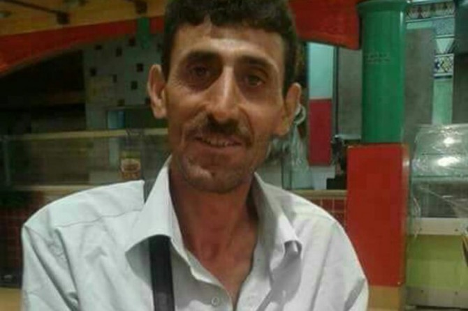 Arının burnundan soktuğu adam hayatını kaybetti