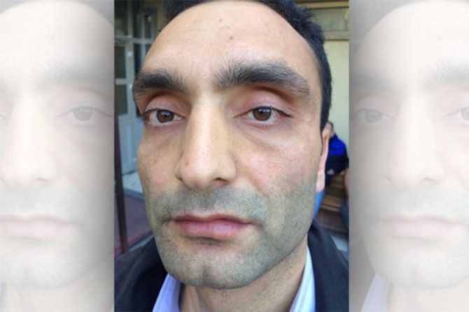 ​Polis engelli vatandaşı darp etti iddiası