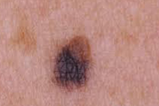 Benlerde ortaya çıkan değişimlere dikkat