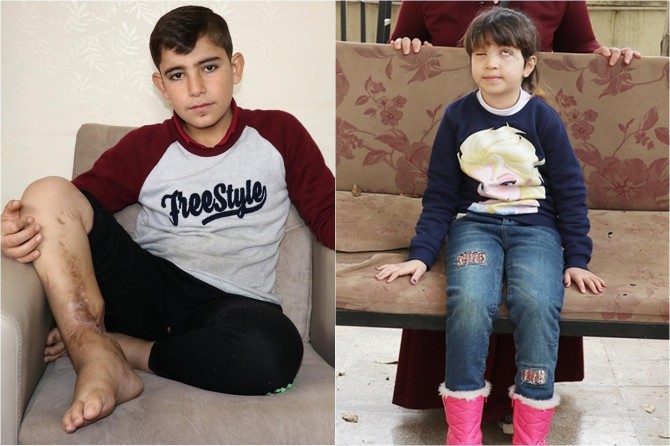 Minik bedenlerinde savaşın derin izlerini taşıyorlar