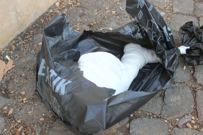 ​Şanlıurfa’da mezarlıkta insana ait kesik bacak bulundu