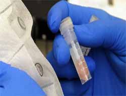 Menenjit Salgınında Ölü Sayısı Artıyor