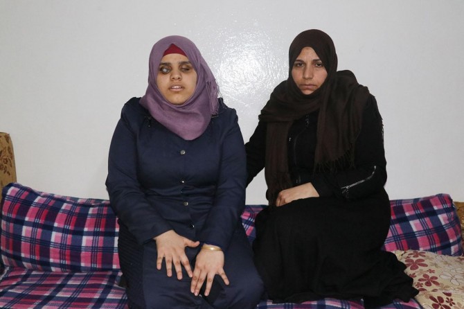 Suriyeli aile görme engelli kızı için yardım bekliyor