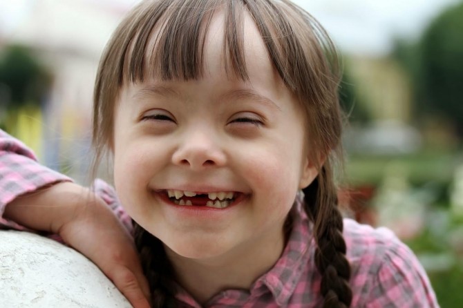 Down Sendromuna müdahalede 1 yaş çok geç