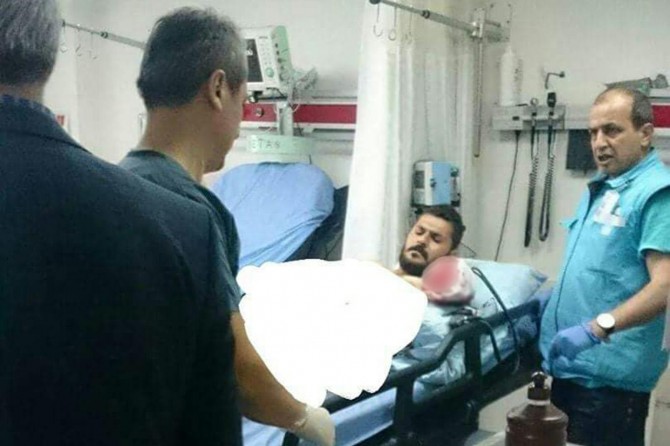 İşçinin makineye kapılan kolu koptu