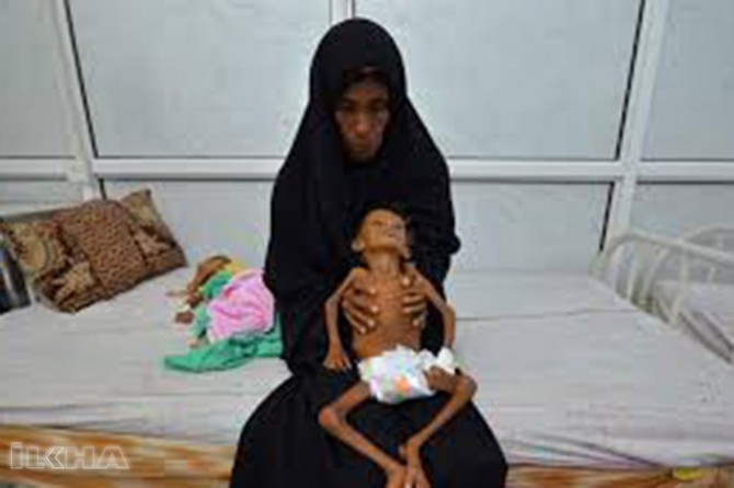 A child dies every 10 minutes in Yemen
