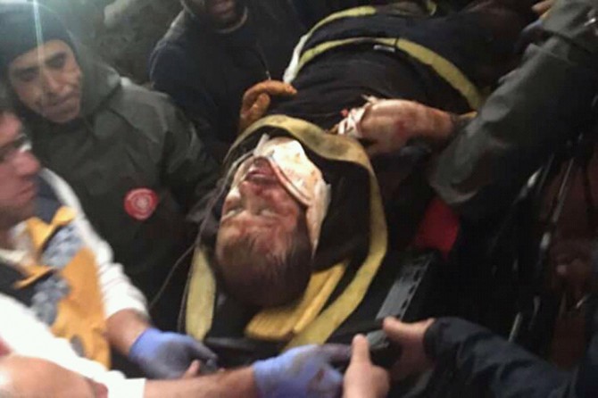 Çöken duvarın altında kalan işçi yaralandı