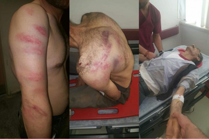 Darp edilen çobanların yakını İLKHA'ya konuştu