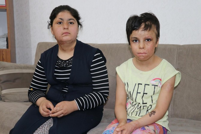 Yüzlerindeki savaşın izlerinin silinmesini istiyorlar