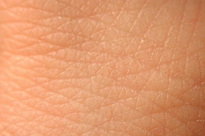 Sıcak havalarda cilt kuruluğuna dikkat