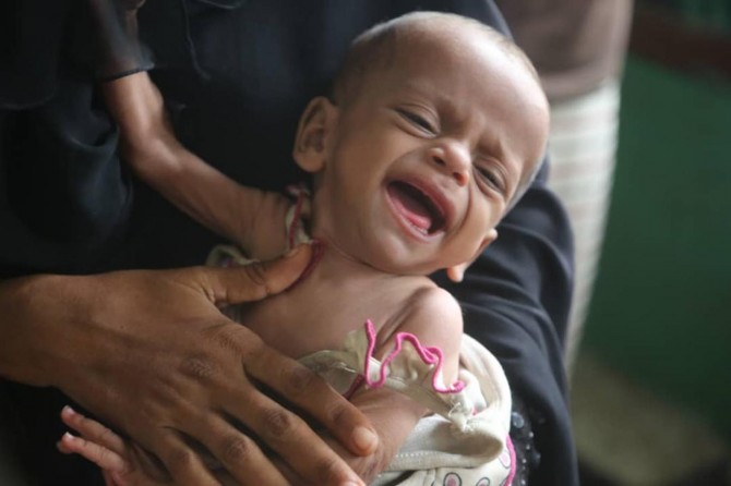 Li Yemenê ji ber nexweşîya kolerayê zêdetirî 2 hezar û 300 kesan jiyana xwe ji dest dan