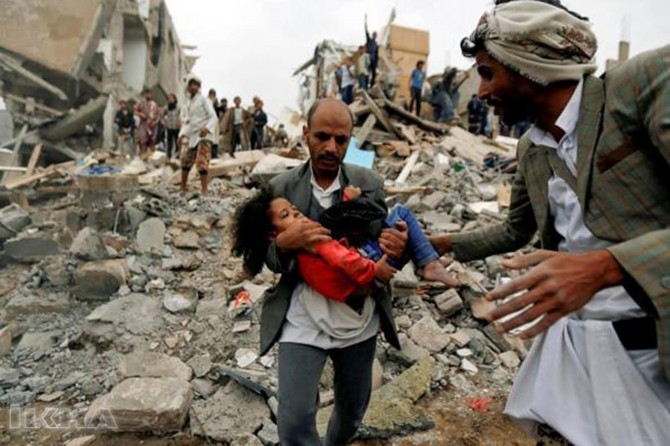 The US shares responsibility for every bloodshed in Yemen