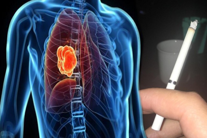 Akciğer kanserinin en önemli risk faktörü sigara