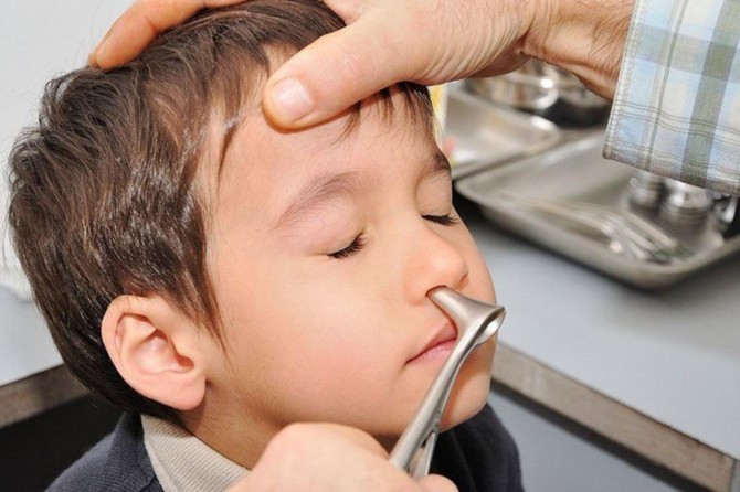 Çocuklarda sinüzitin belirtileri