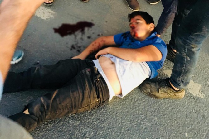 Otomobîlê li zarokê ku dikir derbasî wî alîyê rê bibe qelibî